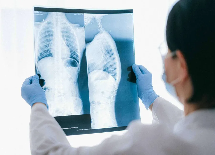 Does Marijuana Cause Lung Cancer