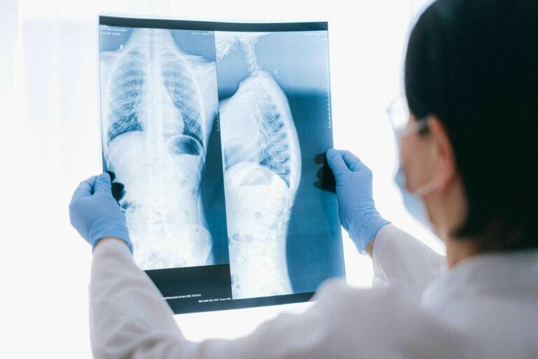 Does Marijuana Cause Lung Cancer